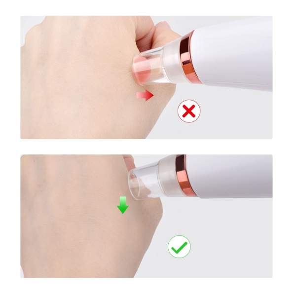 Dispozitiv de îndepărtare a punctelor negre - 6 capete - USB