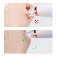 Dispozitiv de îndepărtare a punctelor negre - 6 capete - USB